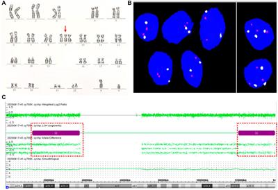 Case report: Detection of fetal trisomy 9 mosaicism by multiple genetic testing methods: Report of two cases